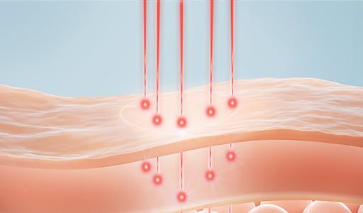 bio-stimulator-laser-img-01 bio-stimulator-laser-img