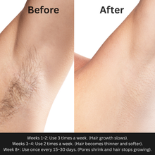 SilkWave Pro Professional IPL Hair Removal System